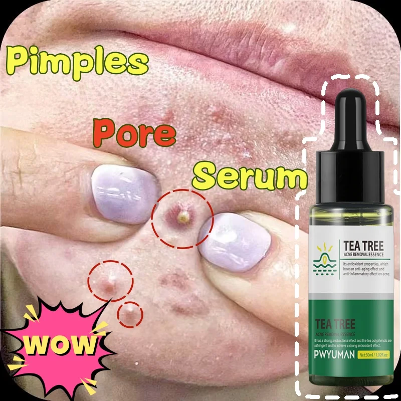 Skin Texture | Pore Refining Resurfacing, Brightening Facial Serum with Retinol and Niacinamide Non-Comedogenic
Skin Texture | Pore Refining Resurfacing, Brightening Facial Serum with Retinol and Niacinamide Non-Comedogenic