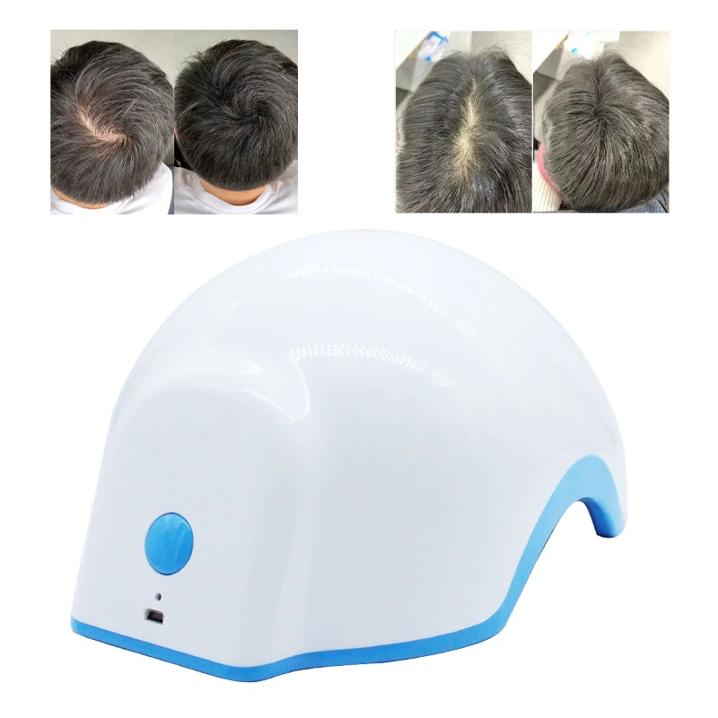 Regrowth Hair Cap Helmet with 80 LED Lamp Beads - Professional Treatment for Hair Loss and Growth
Regrowth Hair Cap Helmet with 80 LED Lamp Beads - Professional Treatment for Hair Loss and Growth