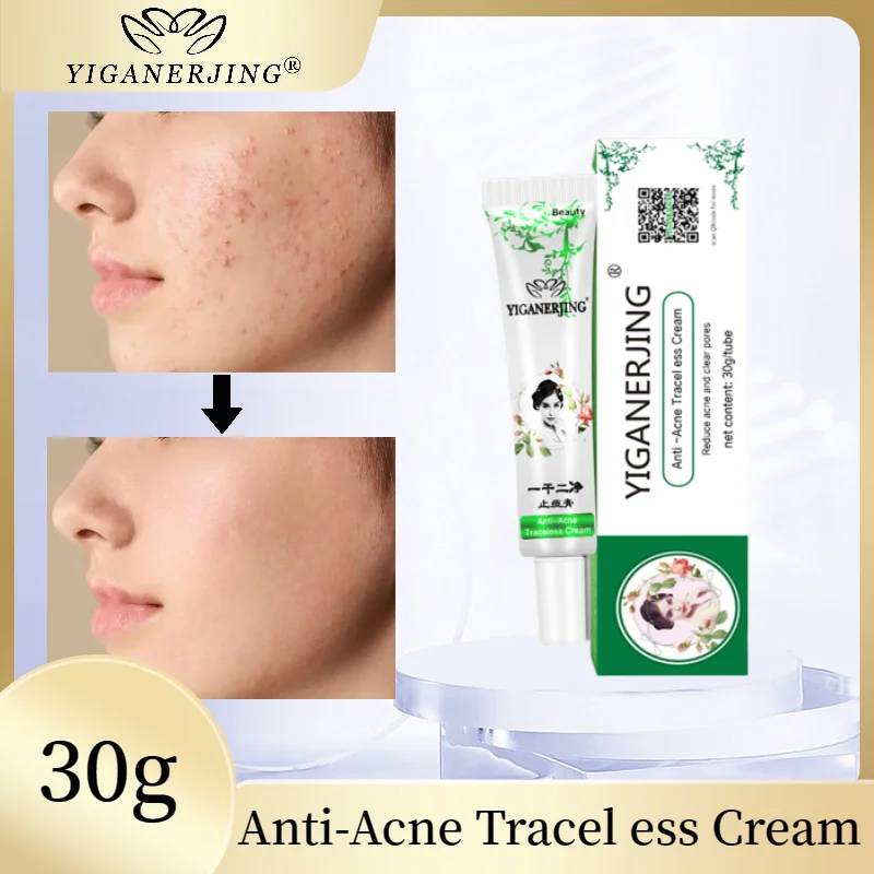 10pcs Yiganerjing Anti-acne Traceless Cream Relieve Acne, Facial Redness, Swelling, and Acne Skin Care
10pcs Yiganerjing Anti-acne Traceless Cream Relieve Acne, Facial Redness, Swelling, and Acne Skin Care