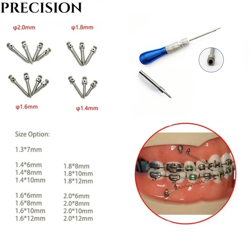 Dental Mini Implants Micro Screw Titanium Alloy Oral Screwdriver Alloy Screws and Screwdrivers Hexagonal Wrench Dental Lab Tools
Dental Mini Implants Micro Screw Titanium Alloy Oral Screwdriver Alloy Screws and Screwdrivers Hexagonal Wrench Dental Lab Tools