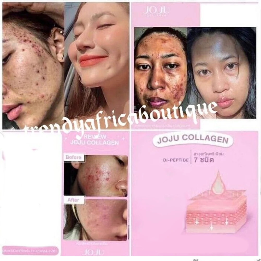 3Bottle JOJU Collagen Dipeptide Reduce Acne Dark Spots Freckles oil control Smooth Lightening Whiten and brighten Younger Skin
3Bottle JOJU Collagen Dipeptide Reduce Acne Dark Spots Freckles oil control Smooth Lightening Whiten and brighten Younger Skin