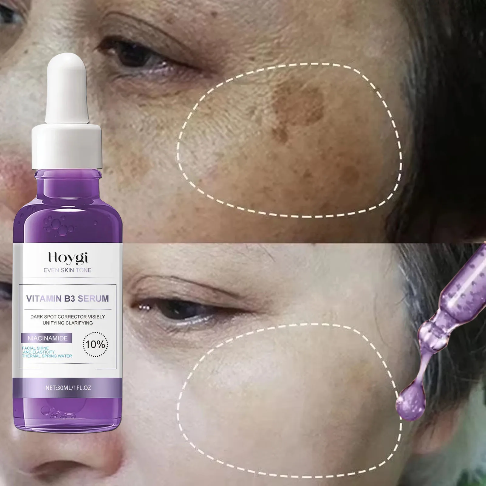 Dark Spots Remover Whitening Serum Face Freckle Melanin Correcting Anti Pigmentation Brighten Beauty Korean Day Night Skin Care
Dark Spots Remover Whitening Serum Face Freckle Melanin Correcting Anti Pigmentation Brighten Beauty Korean Day Night Skin Care