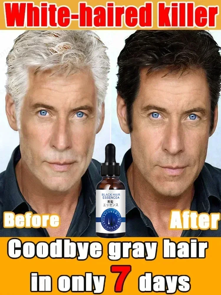 Natural Anti Gray Hair Serum - Repair White & Darkening Hair | Nourishing Hair Care RemedyP
Natural Anti Gray Hair Serum - Repair White & Darkening Hair | Nourishing Hair Care RemedyP