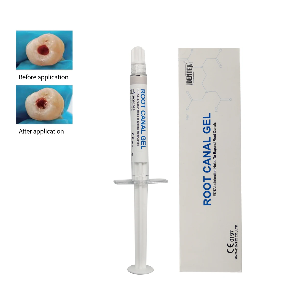 3g 5ml Dental Canal Gel EDTA High-efficiency Enlargement Lubricant Calcium Bound Material Debridement Dental Treatment
3g 5ml Dental Canal Gel EDTA High-efficiency Enlargement Lubricant Calcium Bound Material Debridement Dental Treatment