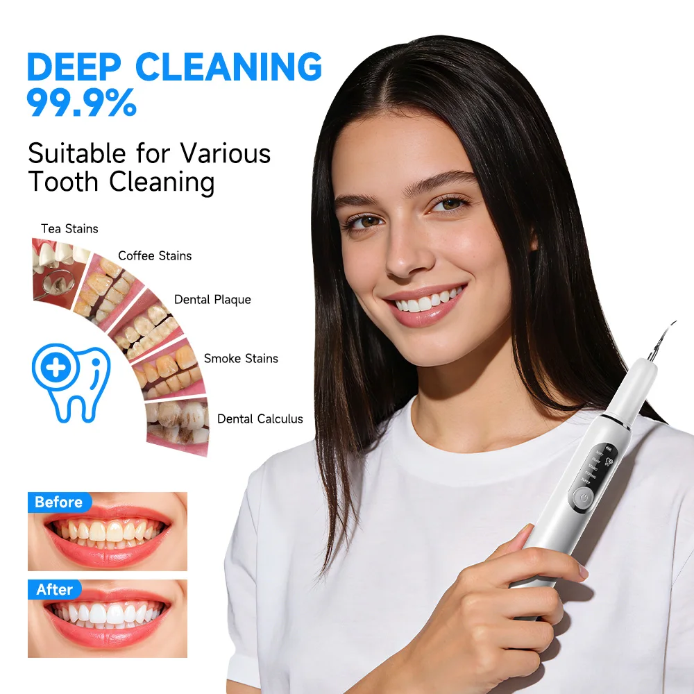 Электрический стоматологический скалер CURVY MOON T6, ультразвуковой очиститель зубов, удаление зубного камня, звуковое средство для удаления налета для чистки зубов
Электрический стоматологический скалер CURVY MOON T6, ультразвуковой очиститель зубов, удаление зубного камня, звуковое средство для удаления налета для чистки зубов