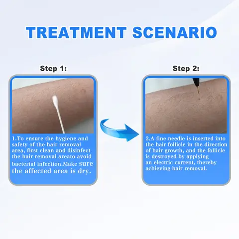 Electrolysis Permanent Hair Removal Machine for Home Salon Permanent Hair Removal Device Permanent Hair Removal Electrolysis