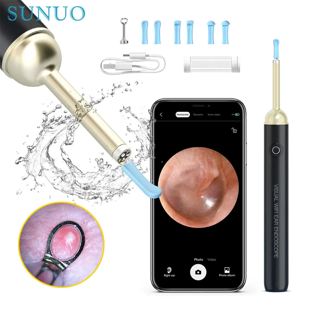 Wireless Visual Ear Cleaner 2 in1 Acne Endoscope Ear Wax Ear 3.5mm Lens Cleaning Kit Removal Sticks 5MP Otoscope Camera Tool
Wireless Visual Ear Cleaner 2 in1 Acne Endoscope Ear Wax Ear 3.5mm Lens Cleaning Kit Removal Sticks 5MP Otoscope Camera Tool