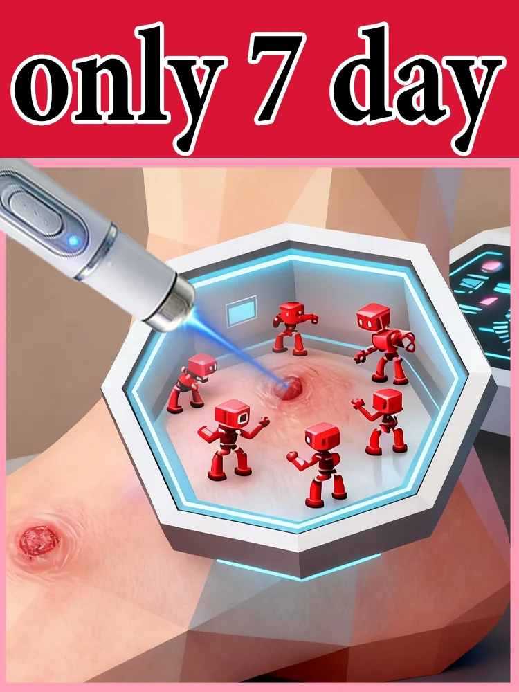 ʙʟᴜᴇ ʟɪɢʜᴛ ᴘᴇɴ sᴏʟᴠᴇ ᴡᴀʀᴛs, ʜᴏᴛ sᴀʟᴇ ᴡᴀʀᴛ ᴄᴀʀᴇ ᴛᴏᴏʟs
ʙʟᴜᴇ ʟɪɢʜᴛ ᴘᴇɴ sᴏʟᴠᴇ ᴡᴀʀᴛs, ʜᴏᴛ sᴀʟᴇ ᴡᴀʀᴛ ᴄᴀʀᴇ ᴛᴏᴏʟs