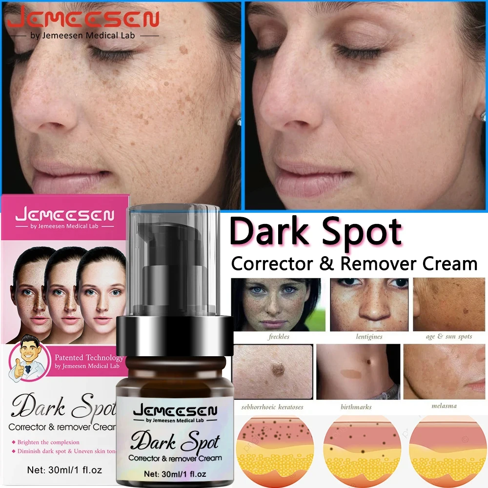Jemeesen Whitening Freckle Cream Effective Dark Spot Remover Spot Corrector Moisturizing Brighten Pigment Face Cream Skin Care
Jemeesen Whitening Freckle Cream Effective Dark Spot Remover Spot Corrector Moisturizing Brighten Pigment Face Cream Skin Care