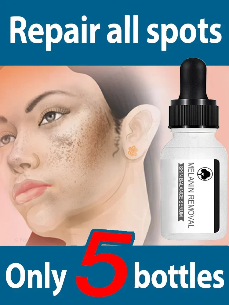 Whitening Lightening Spot Essence To Lighten Chloasma Replenish Water Moisturize Brighten And Beautify Skin Whitening Serum
Whitening Lightening Spot Essence To Lighten Chloasma Replenish Water Moisturize Brighten And Beautify Skin Whitening Serum