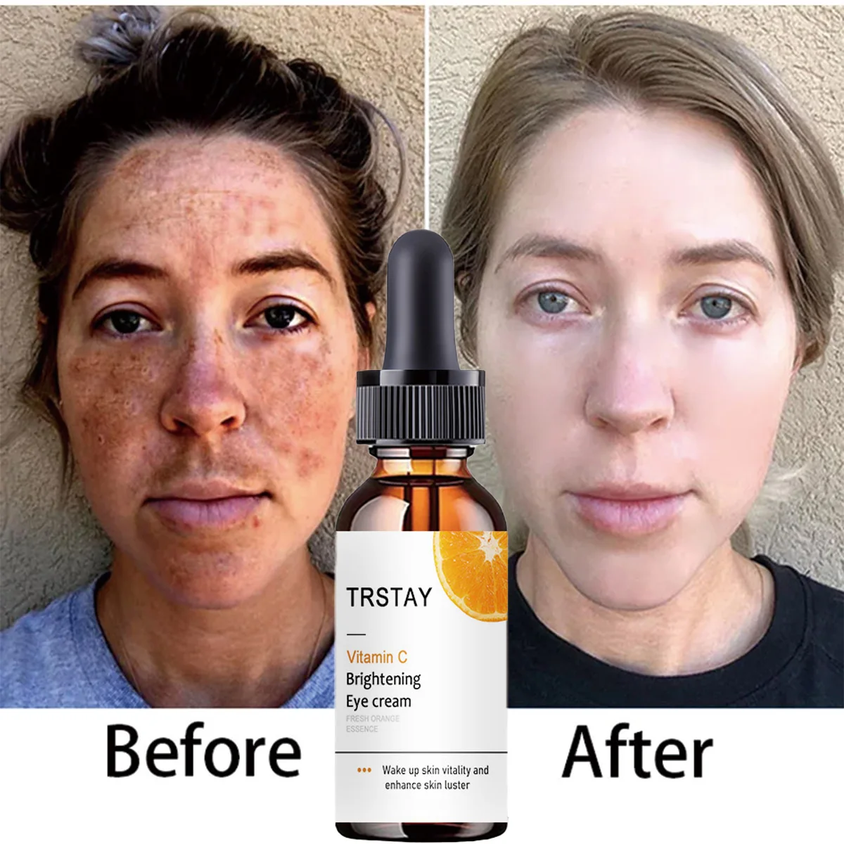 TRSTAY Витамин С Отбеливающий крем для глаз Кожа Витательность Пробуждение и сияние Укрепляющая сыворотка для глаз для мам и детей
TRSTAY Витамин С Отбеливающий крем для глаз Кожа Витательность Пробуждение и сияние Укрепляющая сыворотка для глаз для мам и детей