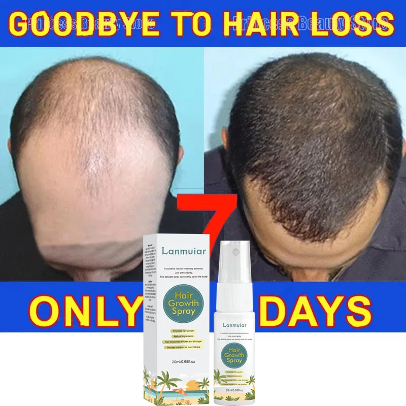 Сыворотка-спрей для быстрого роста волос Rosemary для мужчин и женщин, эфирное масло против выпадения волос, лечение кожи головы, средства по уходу за волосами 
Сыворотка-спрей для быстрого роста волос Rosemary для мужчин и женщин, эфирное масло против выпадения волос, лечение кожи головы, средства по уходу за волосами