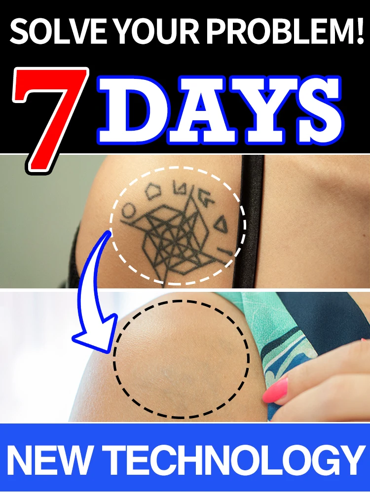 7-Day Effective Tattoo Dissolver, Painlessly Dissolve Pigments, Say Goodbye to Tattoo Troubles 
7-Day Effective Tattoo Dissolver, Painlessly Dissolve Pigments, Say Goodbye to Tattoo Troubles