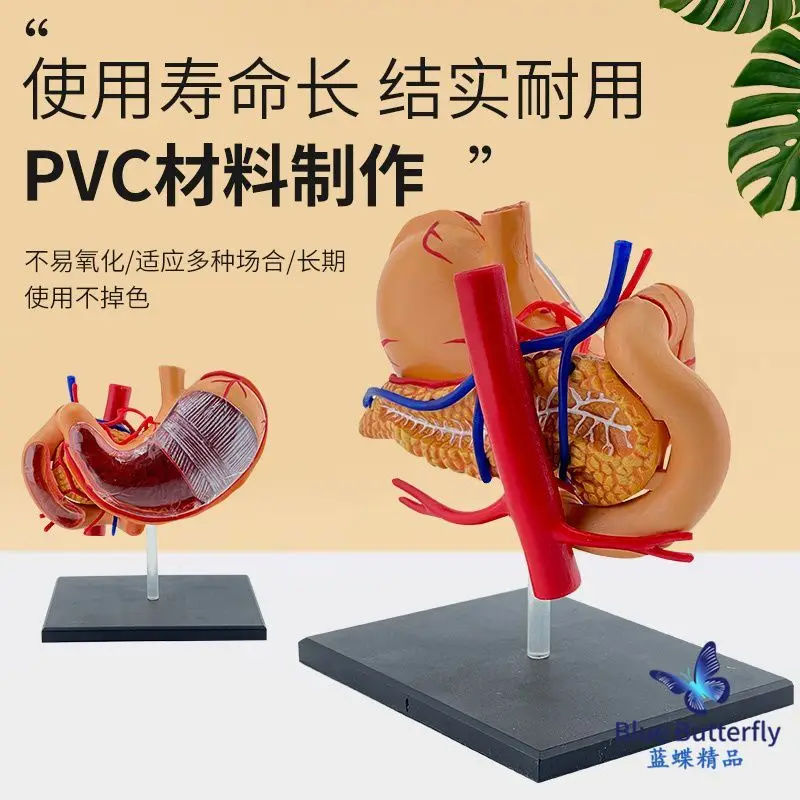 Pathological Stomach Model Pathological Stomach Model Gastroenterology Coronary Section Anatomic Enlargement
Pathological Stomach Model Pathological Stomach Model Gastroenterology Coronary Section Anatomic Enlargement