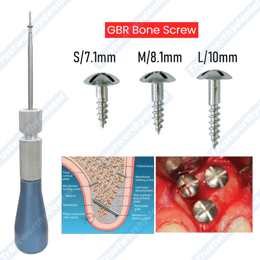 Dental GBR Bone Screw Tent Screw Tacks Universal Handle Tip Guide Bone Regeneration Membrane Tenting Screwdriver
Dental GBR Bone Screw Tent Screw Tacks Universal Handle Tip Guide Bone Regeneration Membrane Tenting Screwdriver