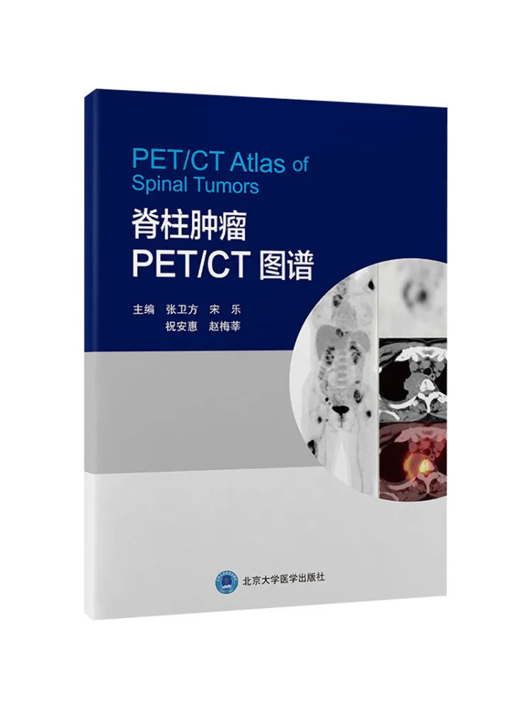 Book-Winshare Spinal Tumor Pet Ct Atlas
Book-Winshare Spinal Tumor Pet Ct Atlas