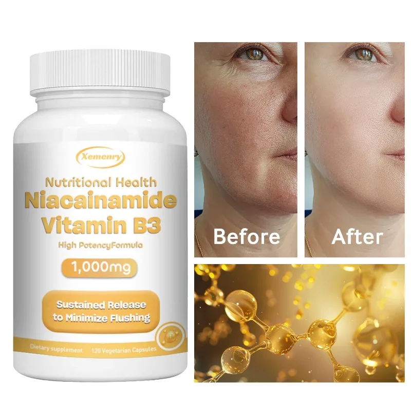 Niacinamide Vitamin B3 Capsules - Supports Brain Function and Heart Health, Boosts Energy Production, and Enhances Immunity
Niacinamide Vitamin B3 Capsules - Supports Brain Function and Heart Health, Boosts Energy Production, and Enhances Immunity