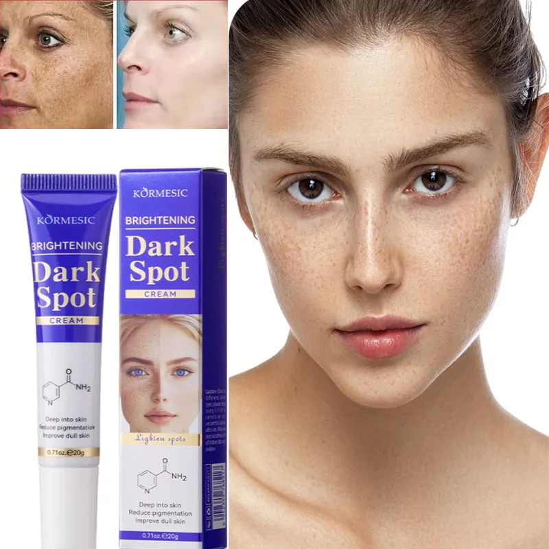 Аминокислотный отбеливающий крем для веснушек, исчезновение пигментации, мелазма, корректор темных пятен, восстанавливающий крем, корейский уход за кожей
Аминокислотный отбеливающий крем для веснушек, исчезновение пигментации, мелазма, корректор темных пятен, восстанавливающий крем, корейский уход за кожей