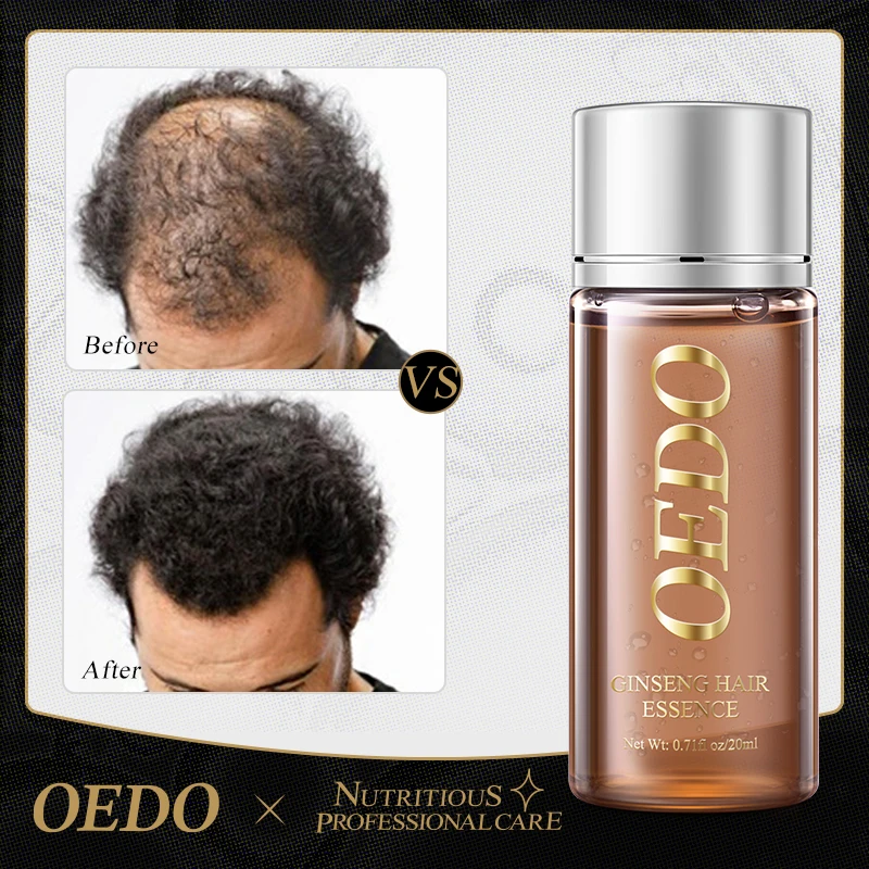 OEDO Ginseng Hair Essence light and smooth hair Improve hair quality Hair and Scalp Repair Anti-Hair Loss Hair Treatment Oil
OEDO Ginseng Hair Essence light and smooth hair Improve hair quality Hair and Scalp Repair Anti-Hair Loss Hair Treatment Oil