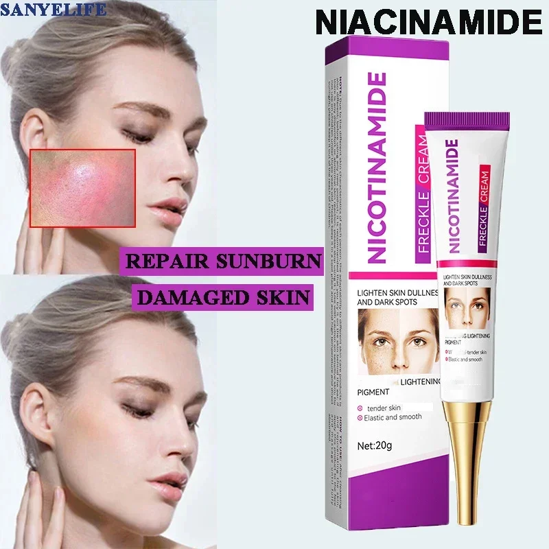 Female Niacinamide brightening Essence Moisturizes repairs the skin Lighten melanin Reduce pigmentation sunburn Even skin tone
Female Niacinamide brightening Essence Moisturizes repairs the skin Lighten melanin Reduce pigmentation sunburn Even skin tone