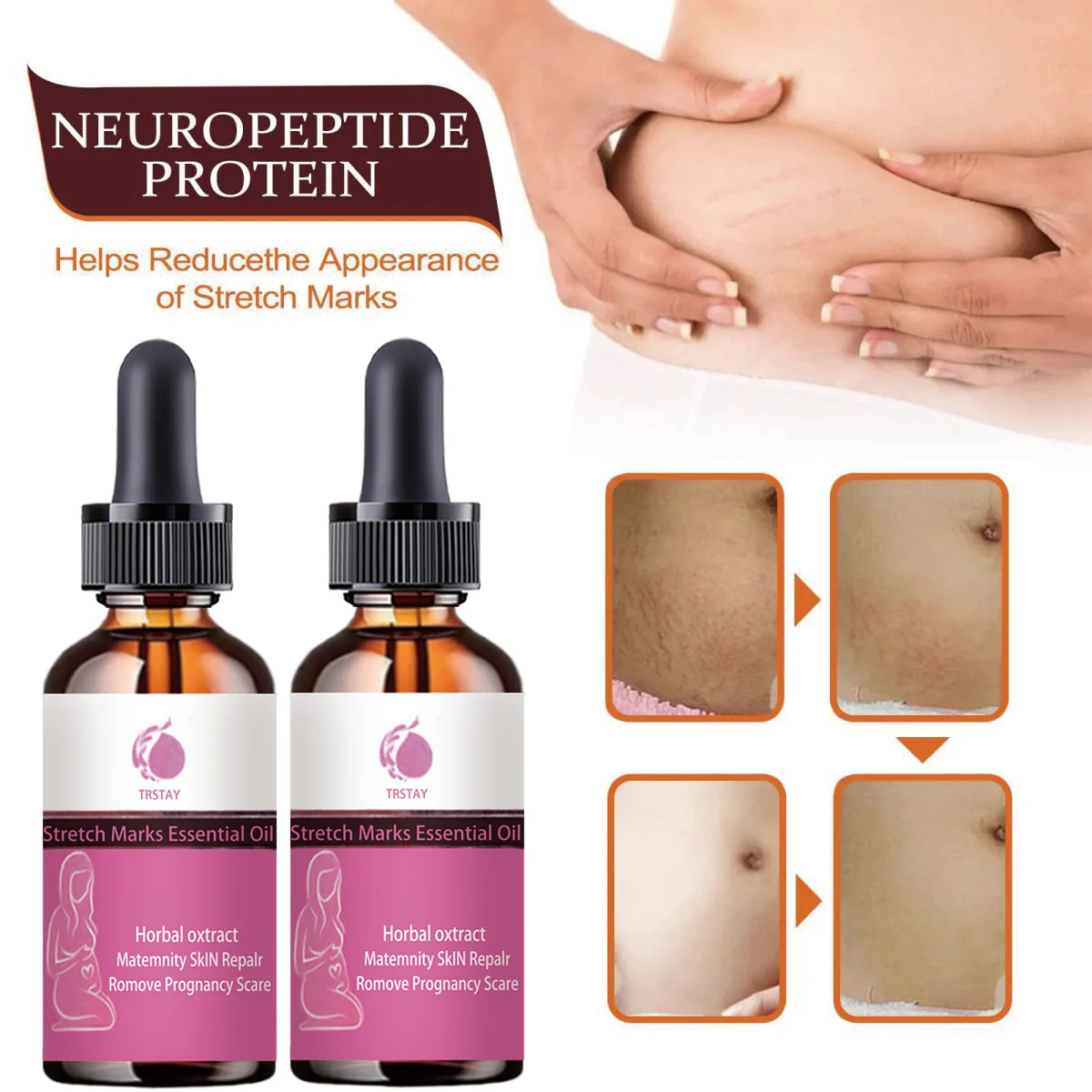 TRSTAY Эфирное масло против растяжек, увлажняющее, легко впитывающее активированное количество кожи для ухода за беременными и беременными 
TRSTAY Эфирное масло против растяжек, увлажняющее, легко впитывающее активированное количество кожи для ухода за беременными и беременными