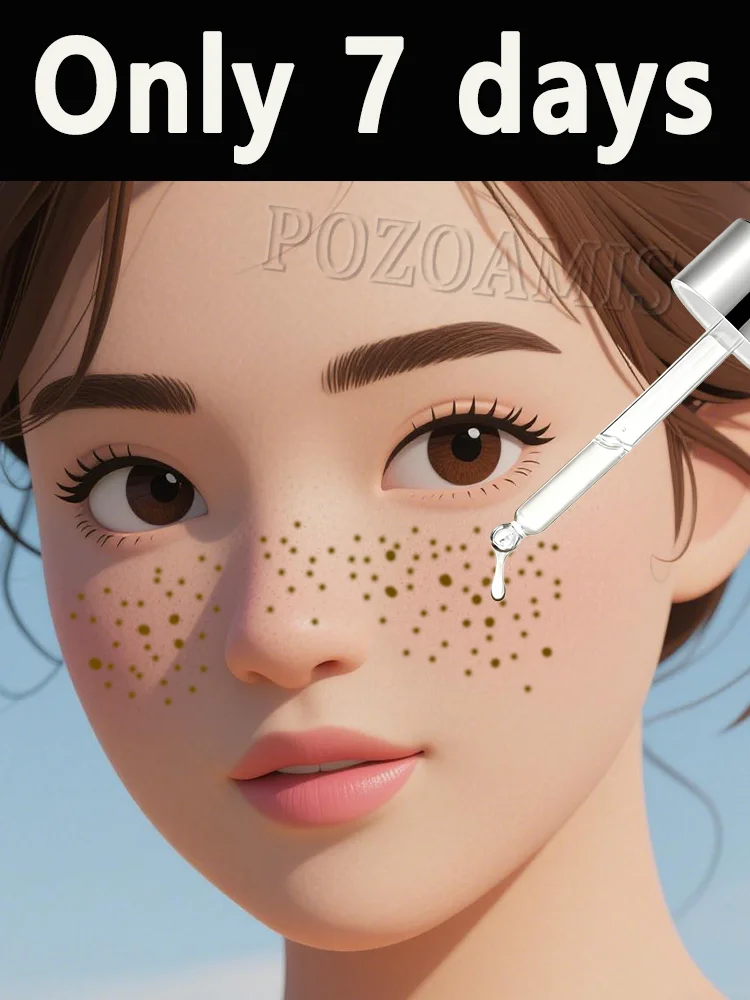 Не применение более консилера делает свою кожу выгляд dirtier
Не применение более консилера делает свою кожу выгляд dirtier