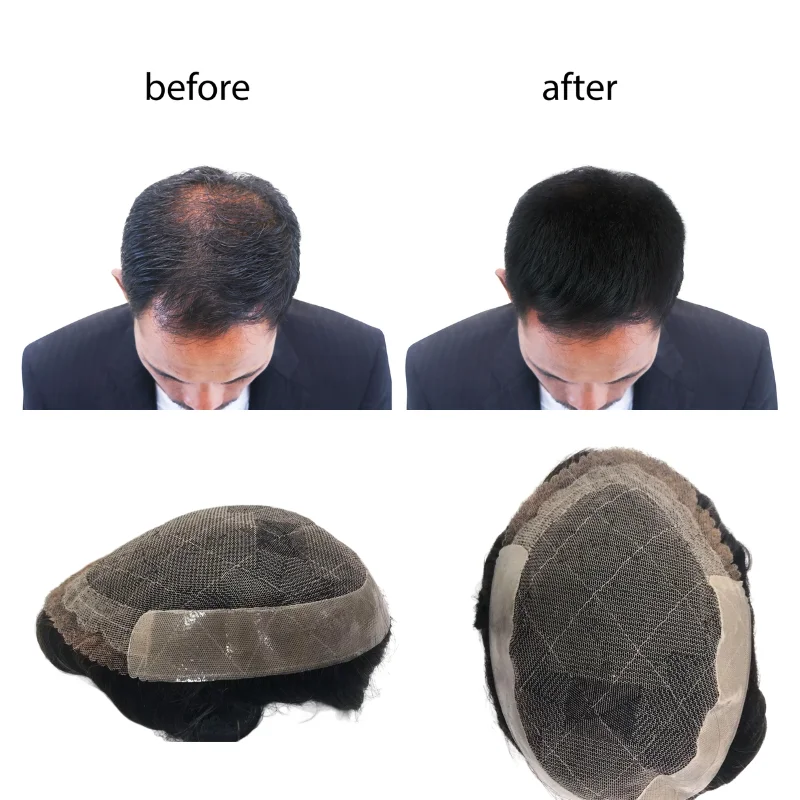 Clearance Men Toupee OCT 100% Human Hair Mono Base Lace+PU Micro Imperfections Low Price Men Wig Replacement For Hair Article
Clearance Men Toupee OCT 100% Human Hair Mono Base Lace+PU Micro Imperfections Low Price Men Wig Replacement For Hair Article