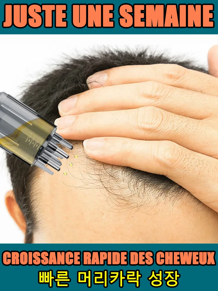 100% revive hair, strong penetration, activate hair roots, more hair, say goodbye to baldness, thick hair
100% revive hair, strong penetration, activate hair roots, more hair, say goodbye to baldness, thick hair