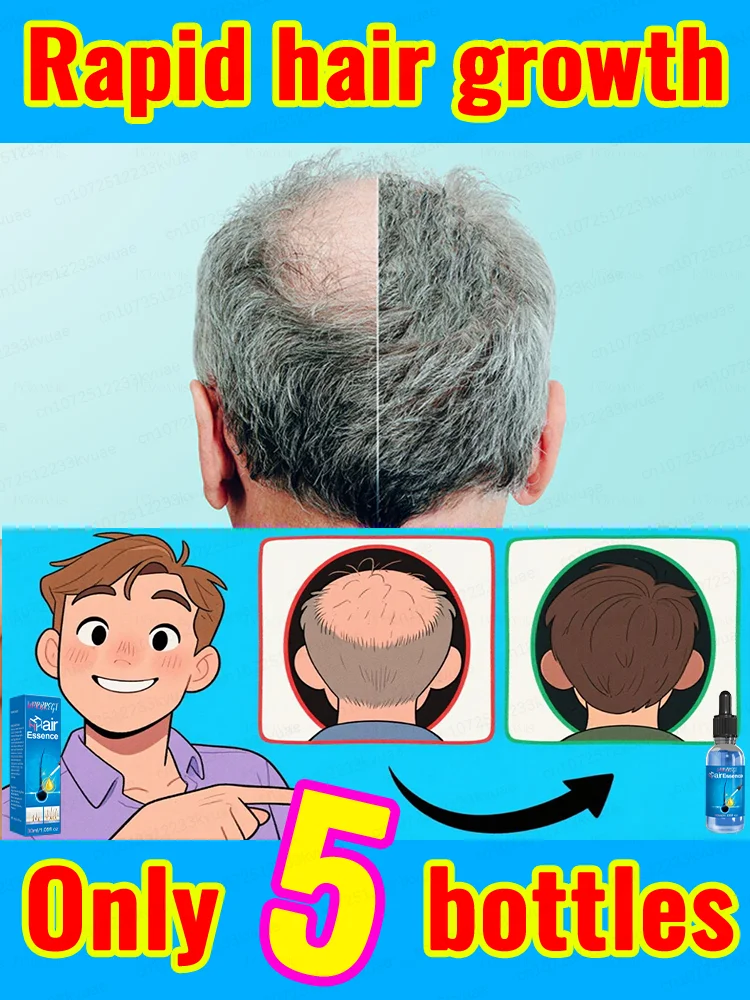 ᴴᵉʳᵇᵃˡ ʰᵃⁱʳ ɢʀᴏᴡᴛʜ ᴏɪʟ ᴘʀᴇᴠᴇɴᴛs ʰᵃⁱʳ loss and helps ᴡɪᴛʜ ʀᴇᴄᴇᴅɪɴɢ ʜᴀɪʀʟɪɴᴇs.
ᴴᵉʳᵇᵃˡ ʰᵃⁱʳ ɢʀᴏᴡᴛʜ ᴏɪʟ ᴘʀᴇᴠᴇɴᴛs ʰᵃⁱʳ loss and helps ᴡɪᴛʜ ʀᴇᴄᴇᴅɪɴɢ ʜᴀɪʀʟɪɴᴇs.