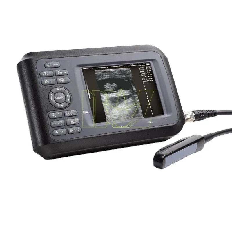 Ветеринарный аппарат MSLVU04 Handscan для ветеринарного/портативного ультразвукового устройства
Ветеринарный аппарат MSLVU04 Handscan для ветеринарного/портативного ультразвукового устройства