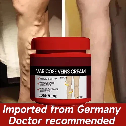 Varicose Veins Ointmnet Vasculitis Phlebitis Spider Cream Varicosity Angiitis Removal Herbal Medical Plaster
Varicose Veins Ointmnet Vasculitis Phlebitis Spider Cream Varicosity Angiitis Removal Herbal Medical Plaster