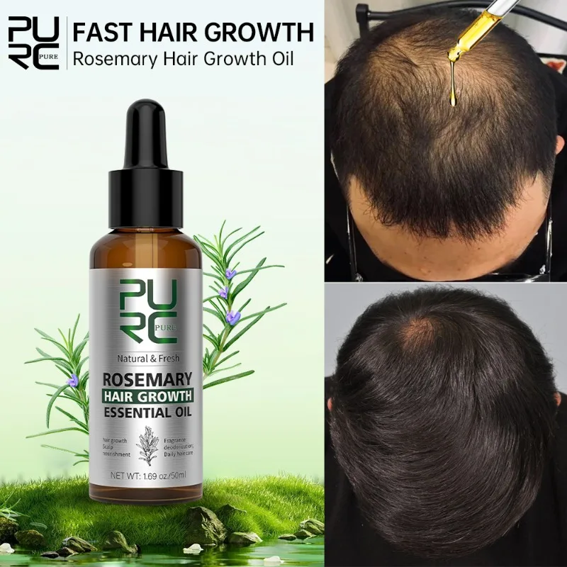 PURC Rosemary Oil Hair Loss Treatment Ginger Hair Growth Products for Men Women Smoothing Anti-Frizz Hair Care
PURC Rosemary Oil Hair Loss Treatment Ginger Hair Growth Products for Men Women Smoothing Anti-Frizz Hair Care