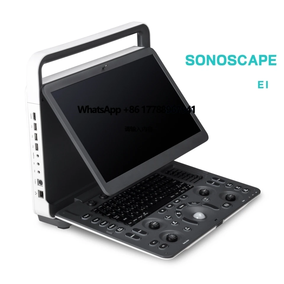Sonoscape Ultrasound E1 E2 E3 Medical Scanner Ultrasound with Good Price Portable Ultrasound Scanner
Sonoscape Ultrasound E1 E2 E3 Medical Scanner Ultrasound with Good Price Portable Ultrasound Scanner