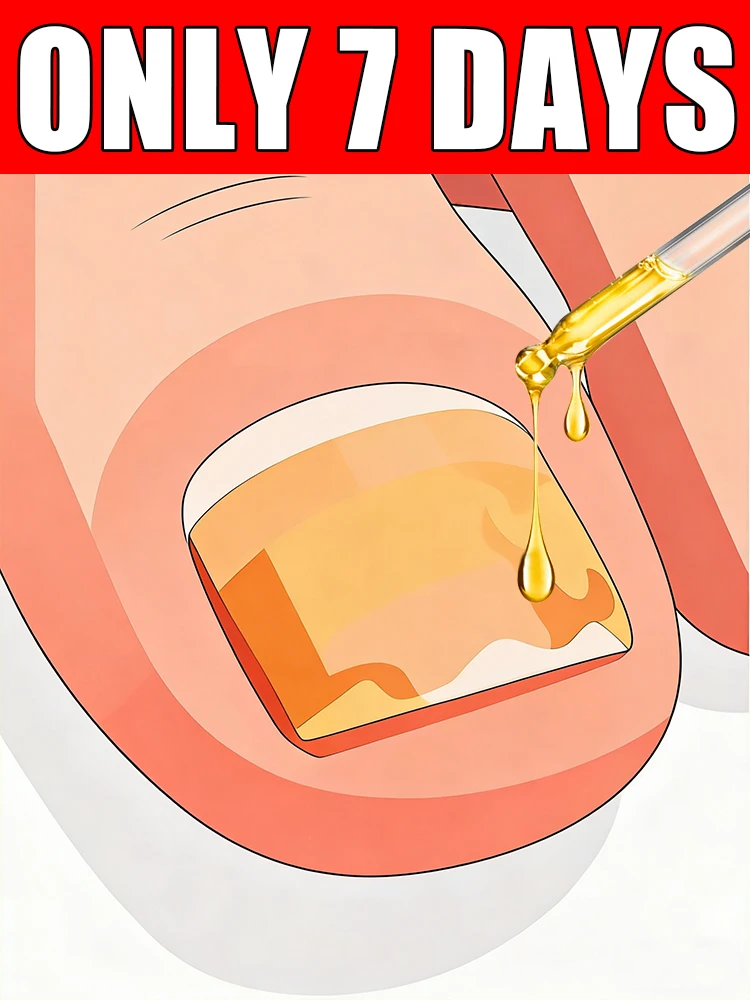 Rᴀᴘɪᴅ Nᴀɪʟ Fᴜɴɢᴜs Sᴏʟᴜᴛɪᴏɴ—Cᴏᴍᴘʟᴇᴛᴇʟʏ ʀᴇsᴏʟᴠᴇs ᴀʟʟ ʏᴏᴜʀ ɴᴀɪʟ ᴘʀᴏʙʟᴇᴍs ᴀɴᴅ ᴄᴏɴᴄᴇʀɴs—100% Eғғᴇᴄᴛɪᴠᴇ.
Rᴀᴘɪᴅ Nᴀɪʟ Fᴜɴɢᴜs Sᴏʟᴜᴛɪᴏɴ—Cᴏᴍᴘʟᴇᴛᴇʟʏ ʀᴇsᴏʟᴠᴇs ᴀʟʟ ʏᴏᴜʀ ɴᴀɪʟ ᴘʀᴏʙʟᴇᴍs ᴀɴᴅ ᴄᴏɴᴄᴇʀɴs—100% Eғғᴇᴄᴛɪᴠᴇ.