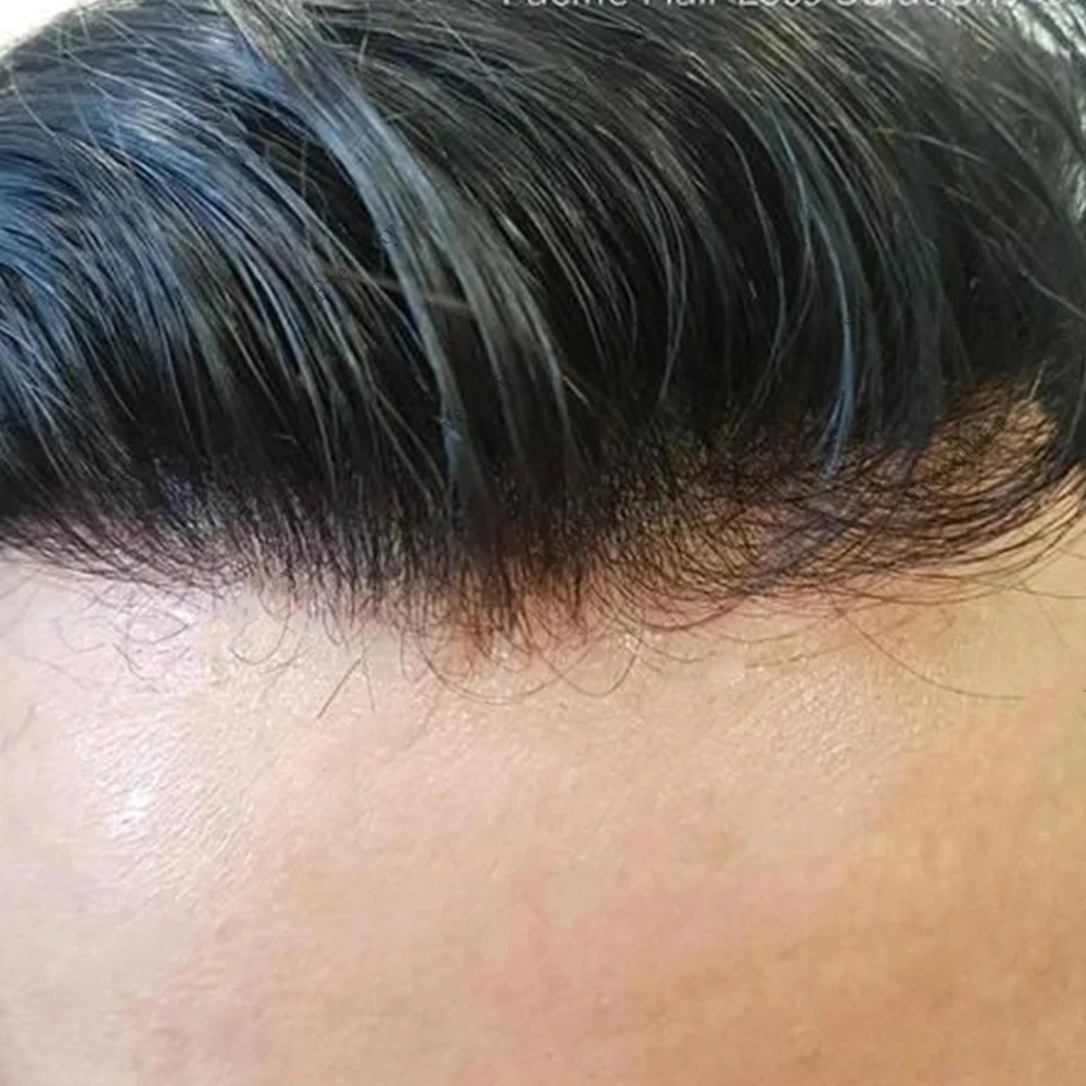 Незаметный мужской парик-накладка Microskin черно-серый 1B20 1B50, прочный, с тонкой кожей, из натуральных волос, полностью на полиуретановой основе, недорогой капиллярный протез
Незаметный мужской парик-накладка Microskin черно-серый 1B20 1B50, прочный, с тонкой кожей, из натуральных волос, полностью на полиуретановой основе, недорогой капиллярный протез