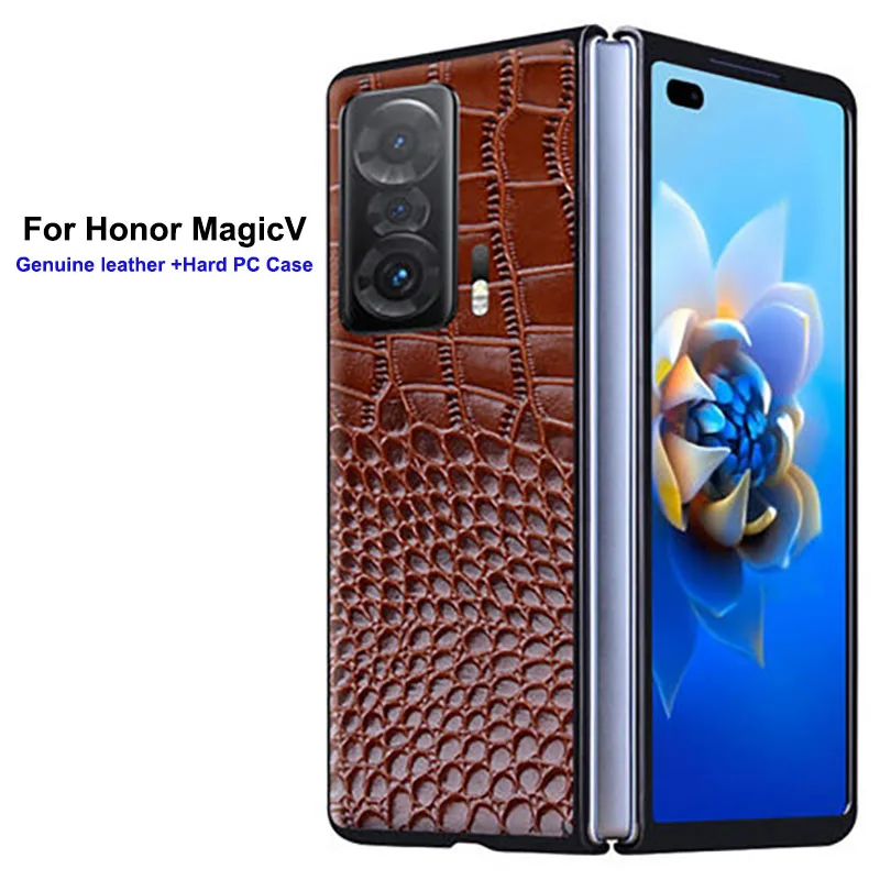 Роскошный чехол-подставка из натуральной кожи для Huawei Honor Magic V Gaming
Роскошный чехол-подставка из натуральной кожи для Huawei Honor Magic V Gaming