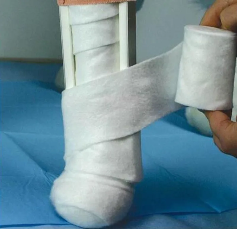 Animal fracture bandaging and filling cotton material, cat and dog dislocation fixation pet joint cotton wool mold
Animal fracture bandaging and filling cotton material, cat and dog dislocation fixation pet joint cotton wool mold