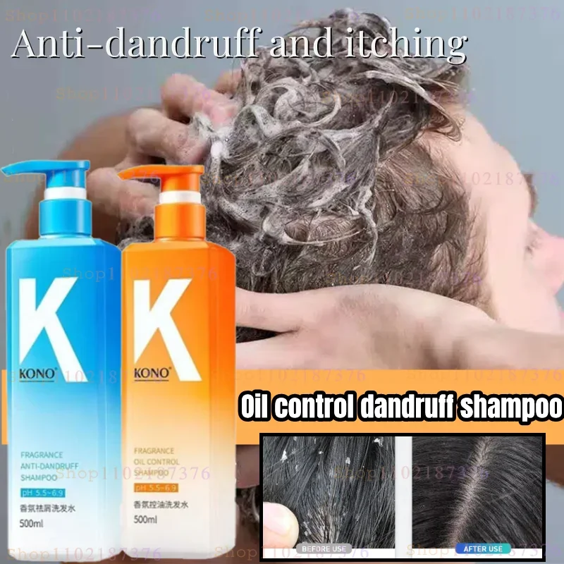 Fragrance Oil Control Anti-dandruff Shampoo Fluffy and Lasting Fragrance Men and Women To Improve Head Itching Anti-dandruff
Fragrance Oil Control Anti-dandruff Shampoo Fluffy and Lasting Fragrance Men and Women To Improve Head Itching Anti-dandruff