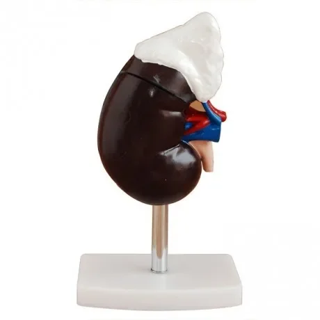 Renal anatomy with adrenal gland model, medical demonstration kidney anatomy mold
Renal anatomy with adrenal gland model, medical demonstration kidney anatomy mold
