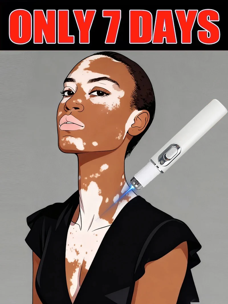 Генерация - 2 лазера «Прощайтесь к витилиго» в течение 7 дней
Генерация - 2 лазера «Прощайтесь к витилиго» в течение 7 дней