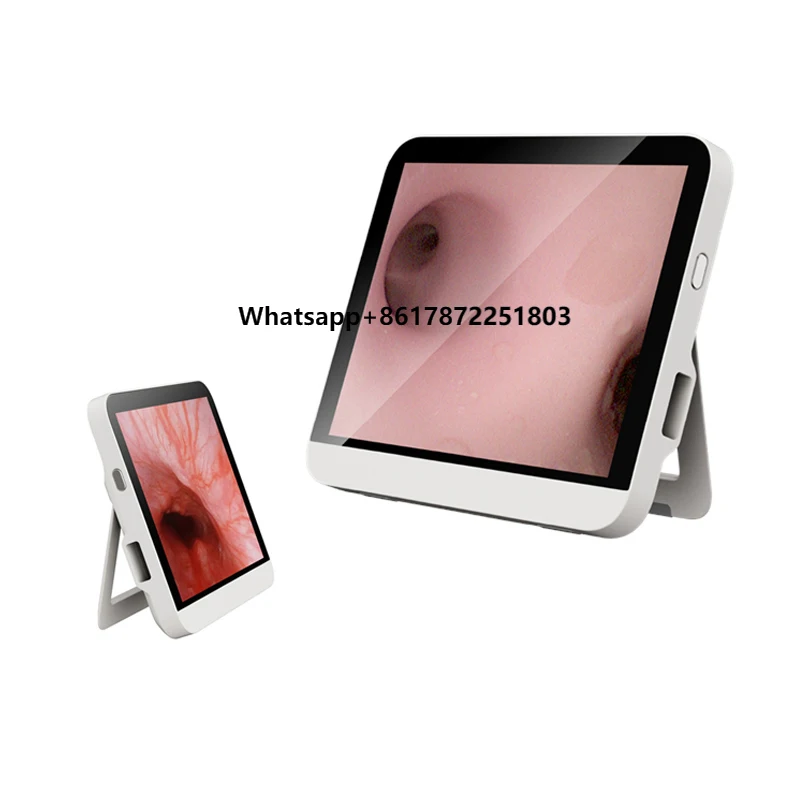 Euprun Ureteroscope Bronchscope Hysteroscope Choledochoscope Endoscope Portable Image Processor HD
Euprun Ureteroscope Bronchscope Hysteroscope Choledochoscope Endoscope Portable Image Processor HD