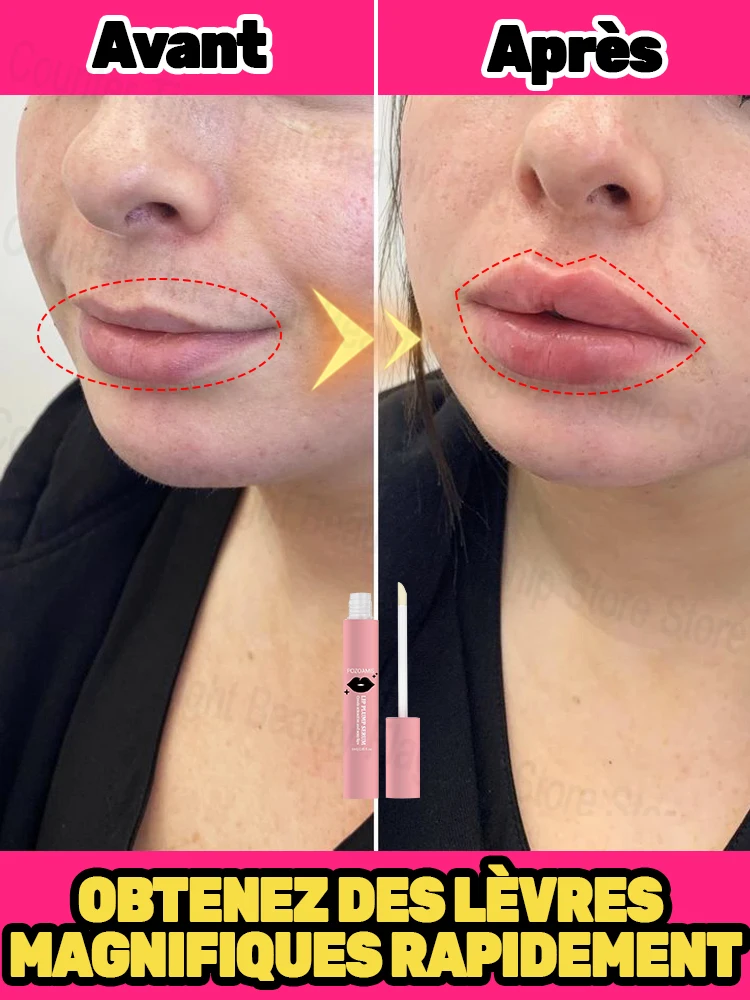 Губы быстро становится больше и создают идеальной формы губ.
Губы быстро становится больше и создают идеальной формы губ.