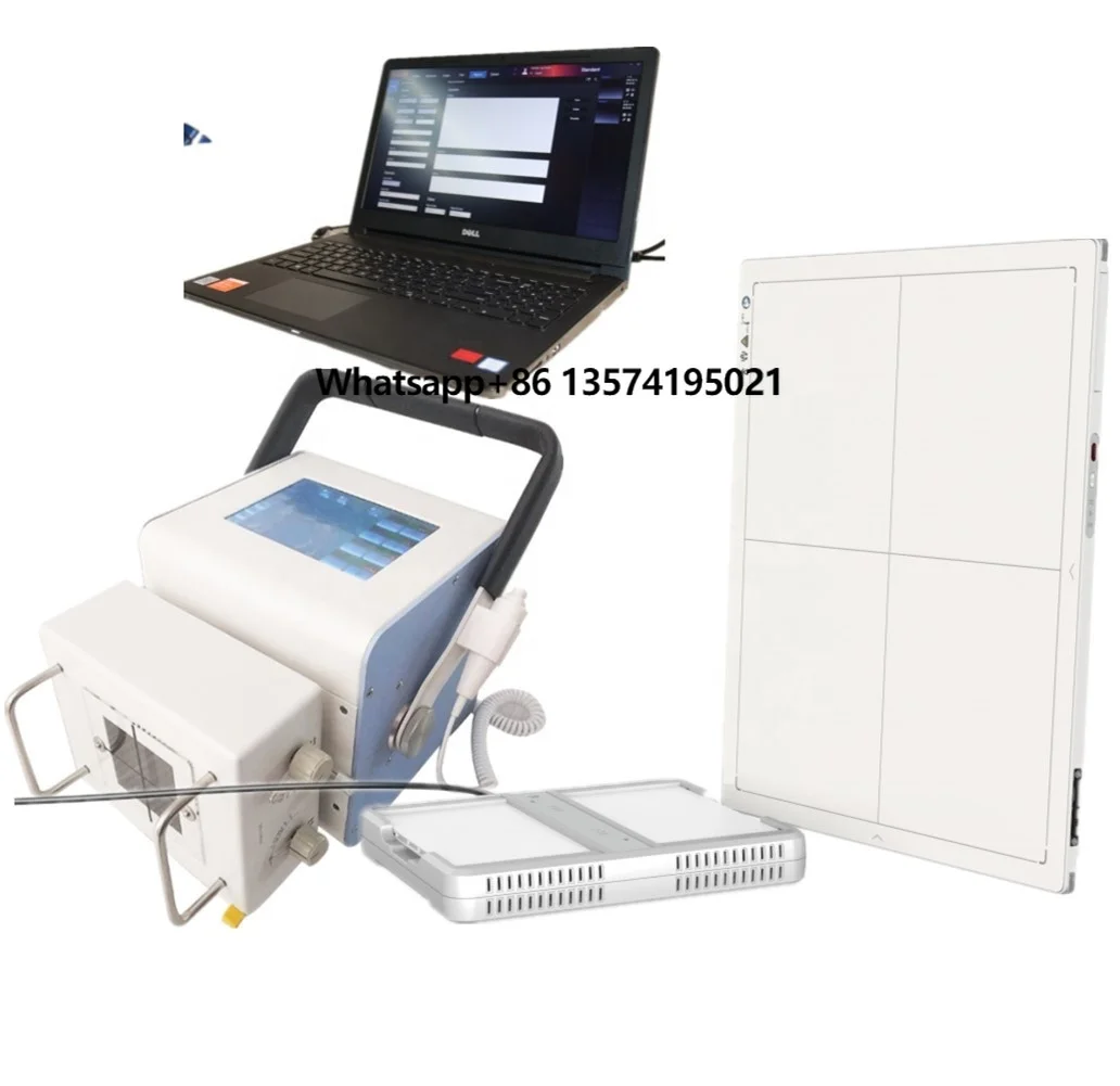MSLFP03 14*17 Wireless X-ray Detector High-quality Flat Panel Detector X Ray for Human and Pet
MSLFP03 14*17 Wireless X-ray Detector High-quality Flat Panel Detector X Ray for Human and Pet