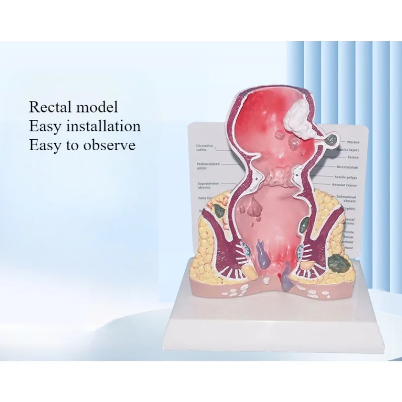 Human Digestive and Rectal System Model Specialist Teaching Rectal Model Demonstration Model
Human Digestive and Rectal System Model Specialist Teaching Rectal Model Demonstration Model