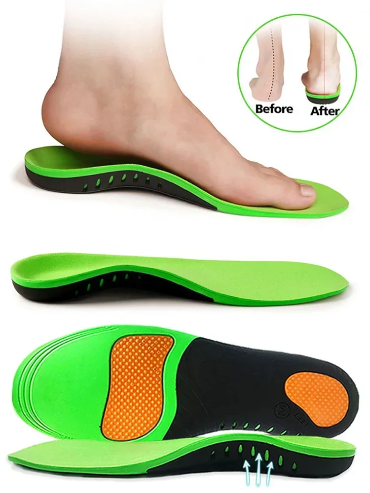 2pc Insole Orthopedic X/O Leg Correction Cuttable High Elastic Cushion Outdoor Hiking Travel Essentials Flat Arch Support Sports
2pc Insole Orthopedic X/O Leg Correction Cuttable High Elastic Cushion Outdoor Hiking Travel Essentials Flat Arch Support Sports