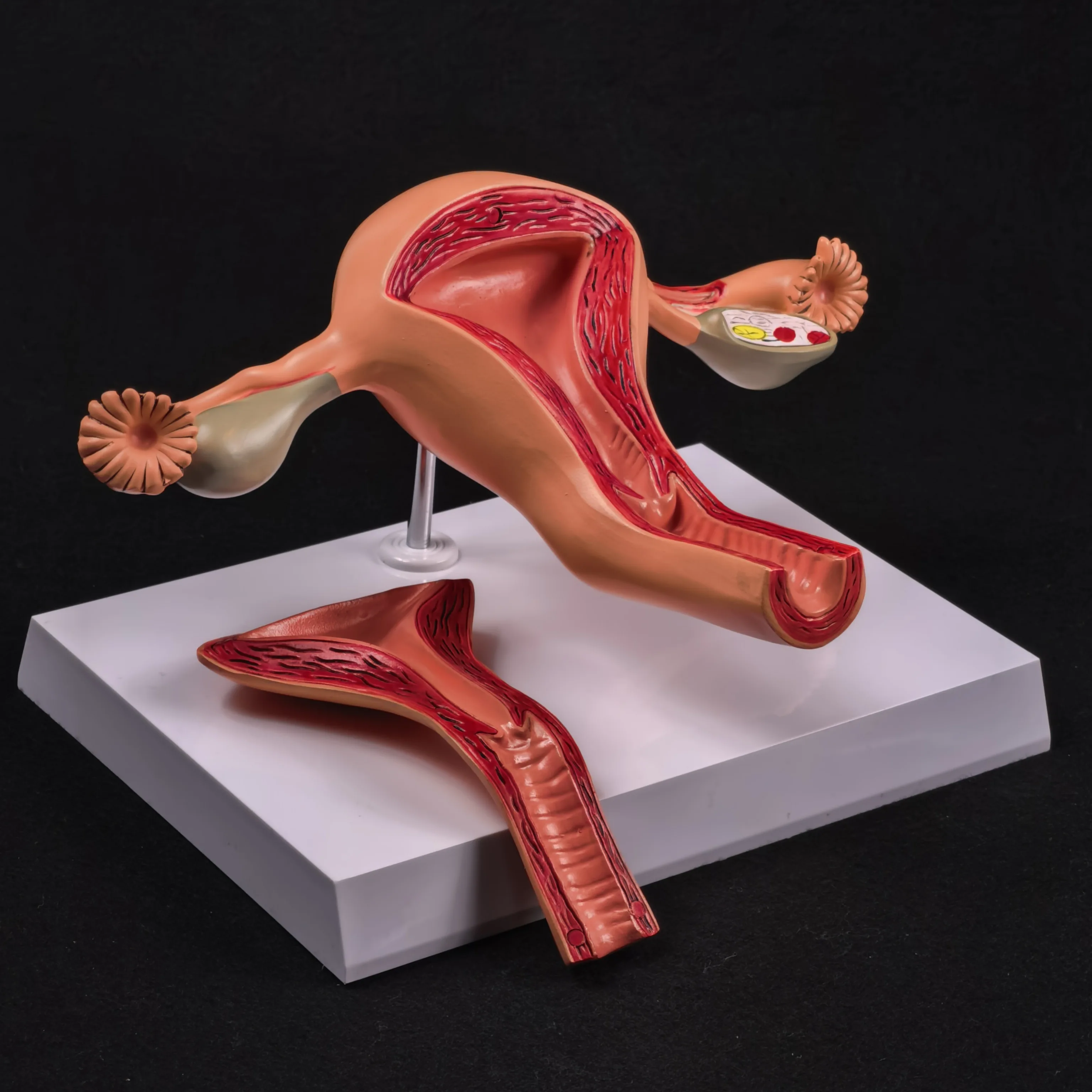 ПВХ 2-х частей анатомическая здоровая человеческая матка и модель яичника женские медицинские учебные принадлежности для анатомии
ПВХ 2-х частей анатомическая здоровая человеческая матка и модель яичника женские медицинские учебные принадлежности для анатомии