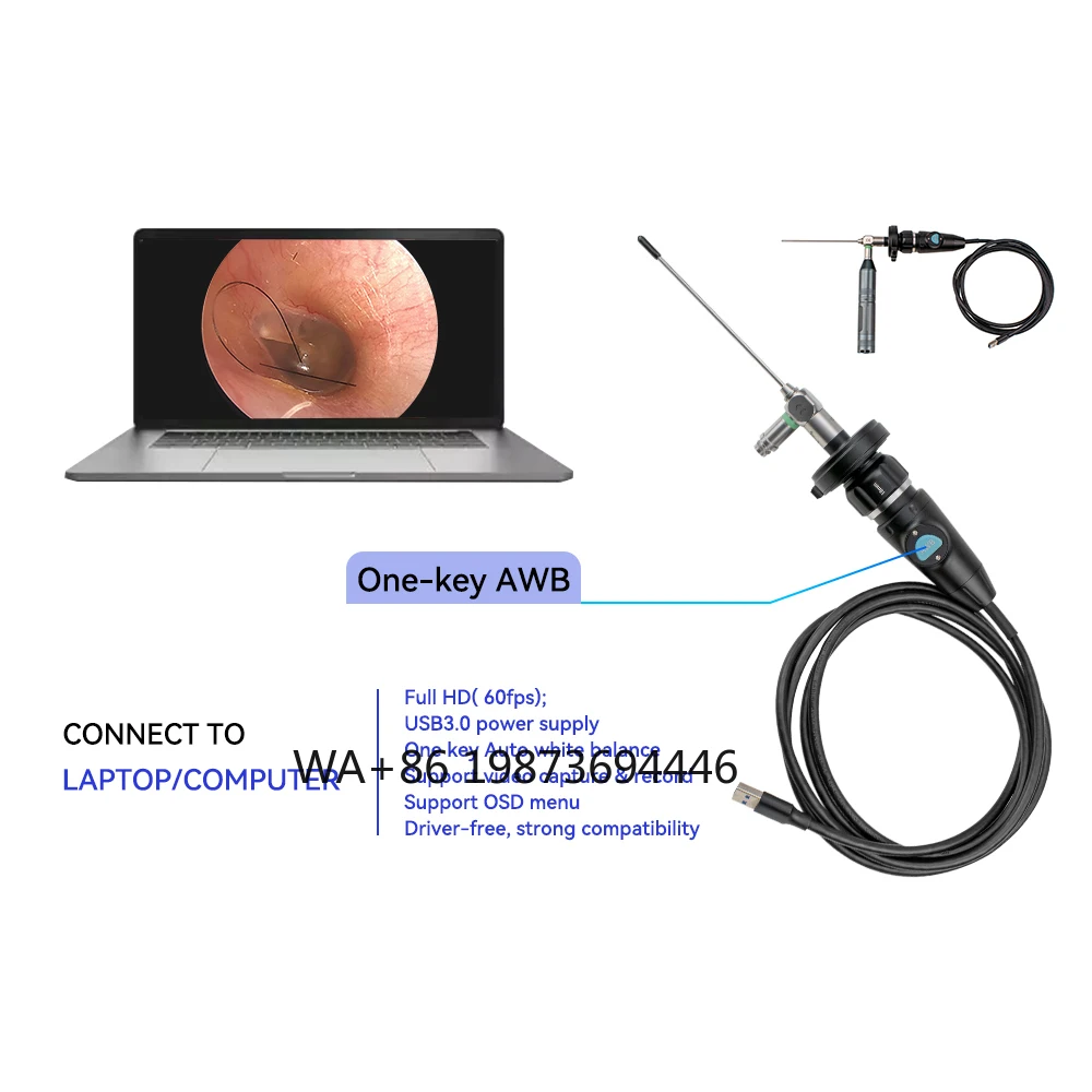 Ear Pick Pet Ent Detection Portable USB 3.0 Endoscopic Handle Portable Endoscopic System
Ear Pick Pet Ent Detection Portable USB 3.0 Endoscopic Handle Portable Endoscopic System