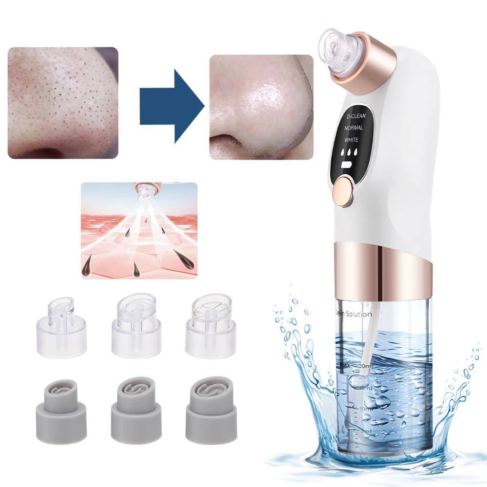 Новая модернизированная версия для удаления черных точек с маленькими пузырьками и наклонным экраном, специально разработанная для различных типов кожи, перезаряжаемая от USB
Новая модернизированная версия для удаления черных точек с маленькими пузырьками и наклонным экраном, специально разработанная для различных типов кожи, перезаряжаемая от USB