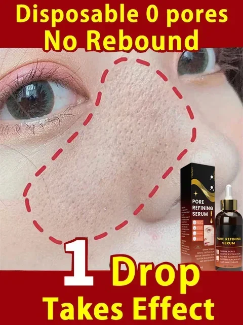 2495 Pore Minimizer Serum Shrink Pores Relieve Dryness Oil Control Pores Remover Pores Tightening Refining Face Serum Skin Care
2495 Pore Minimizer Serum Shrink Pores Relieve Dryness Oil Control Pores Remover Pores Tightening Refining Face Serum Skin Care