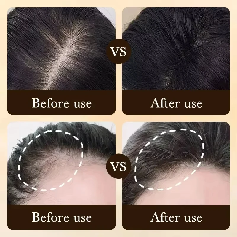 ᴴⁱᵍʰ ᴿᵉᵖᵘʳᶜʰᵃˢᵉ,ᴴᵃⁱʳ ᴳʳᵒʷᵗʰ ᴼⁱˡ,Biotin DHT Blocker,Anti-Loss Shampoo,Boost Regrowth,Increase Production of Shampoo,hair Growth
ᴴⁱᵍʰ ᴿᵉᵖᵘʳᶜʰᵃˢᵉ,ᴴᵃⁱʳ ᴳʳᵒʷᵗʰ ᴼⁱˡ,Biotin DHT Blocker,Anti-Loss Shampoo,Boost Regrowth,Increase Production of Shampoo,hair Growth